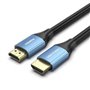 Cabo HDMI 2.0 4K Vention ALHSE/ HDMI Macho - HDMI Macho/ 75cm/ Azul